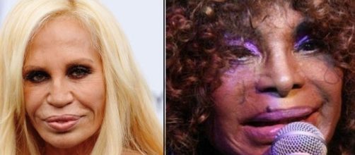 Estas mulheres se submeteram a diversas interven&ccedil;&otilde;es est&eacute;ticas e o resultado gerou bastante inc&ocirc;modo