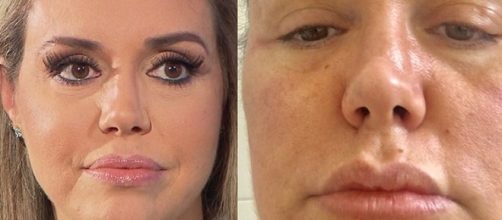 Renata Banhara contou detalhes sobre o drama que tem vivido