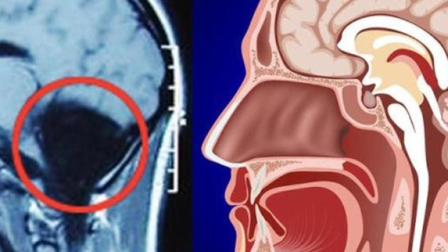 Ho nausea e svenimenti&raquo;: dopo 24 anni scopre di vivere senza il ... - ilmattino.it