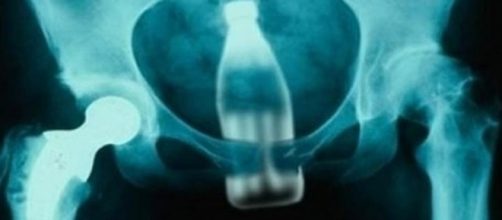 Alguns s&atilde;o bizarros (Foto: Reprodu&ccedil;&atilde;o)