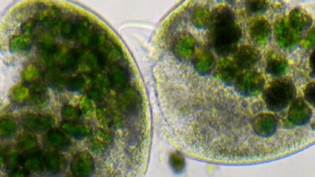 Esiste un batterio super resistente: non c'&egrave; antibiotico che lo uccida