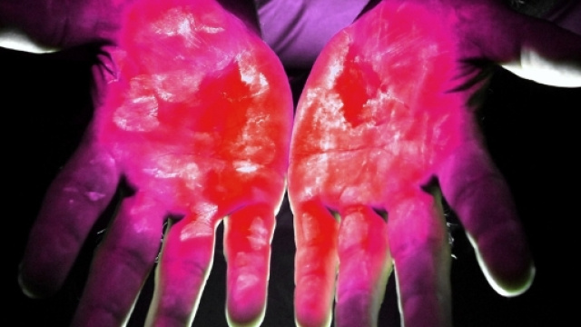 L'allarme della comunit&agrave; scientifica contro i batteri super resistenti