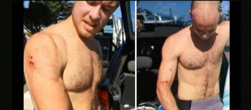 A British surfer survived a shark attack by punching it in the face. [Image credit: Guardian News/Youtube screencap]
