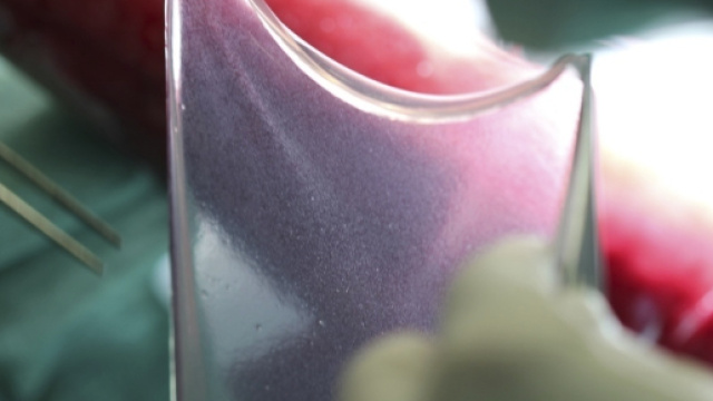 Lembo della pelle ricostruita (Fonte: Ruhr University Bochum)