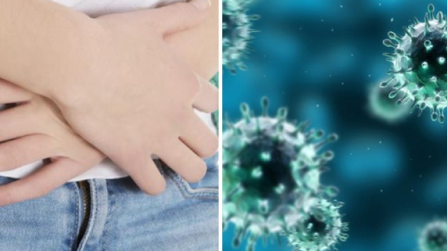 Infezione da botulino - Sintomi