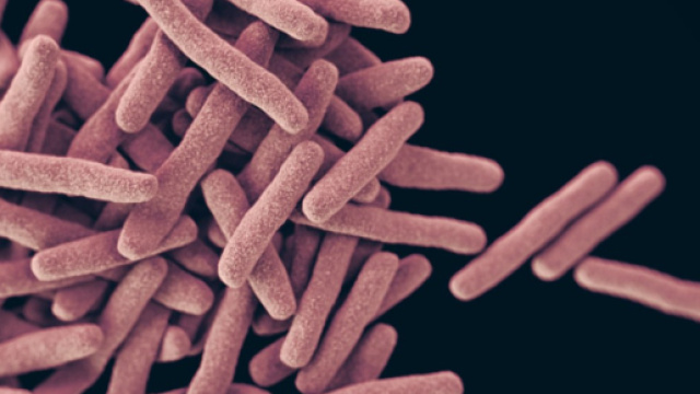 KPC: nuovo batterio killer fa paura