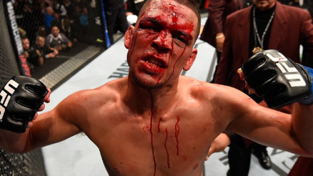 Nate Diaz's Coach: We Want $20 Mil to Fight Conor McGregor, At Least! - ringside24.com