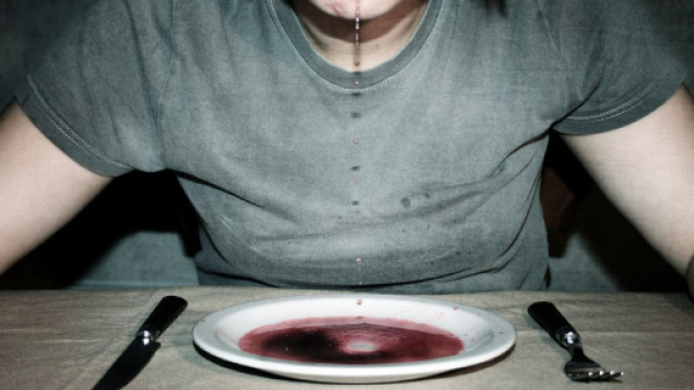 E' stato chiuso un blog pro-anoressia