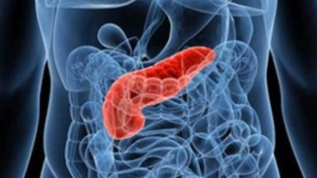 Tumore al pancreas: le ultime news dopo la giornata mondiale dedicata a questa terribile malattia - newsitaliane.it