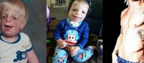 Jono Lancaster, antes e depois