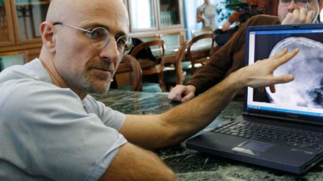 Passi avanti per il trapianto di testa?