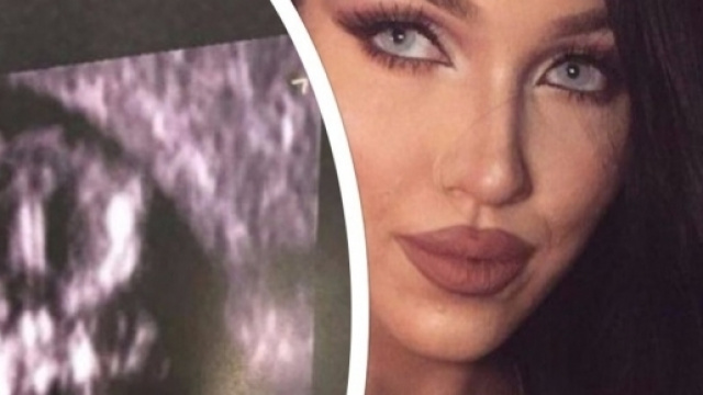 L'immagine ecografica diabolica del bambino