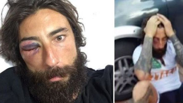 Brumotti aggredito posta foto con l'occhio nero su Twitter: sto ... - ilmessaggero.it