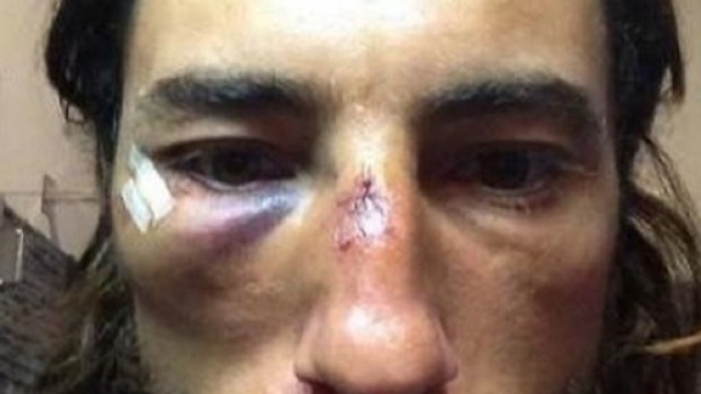 Brumotti nuovamente aggredito a Bologna