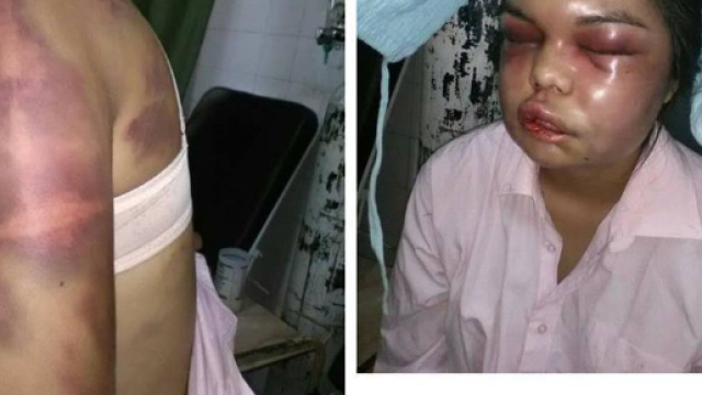 Il marito la picchia per ogni like ricevuto su Facebook, 21enne in ... - leggo.it