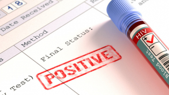 L'HIV non fa pi&ugrave; paura? Ecco l'ultimo allarme lanciato dall'OMS - foto:thesun.co.uk