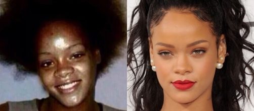 Famosos antes e depois da fama