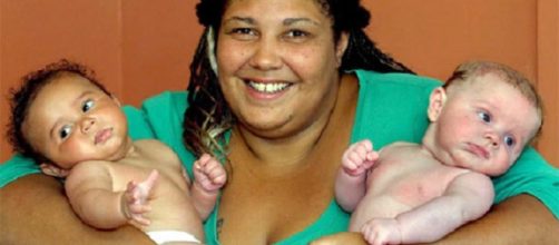 Mulher teve g&ecirc;meos de pais diferentes