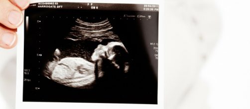 State laws differ about the legal status of unborn children. Photo by PublicDomainPictures at Pixabay.com, Creative Commons license.