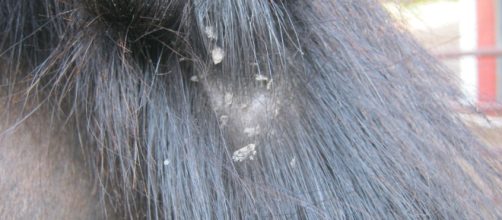 Como eliminar la caspa de forma natural.