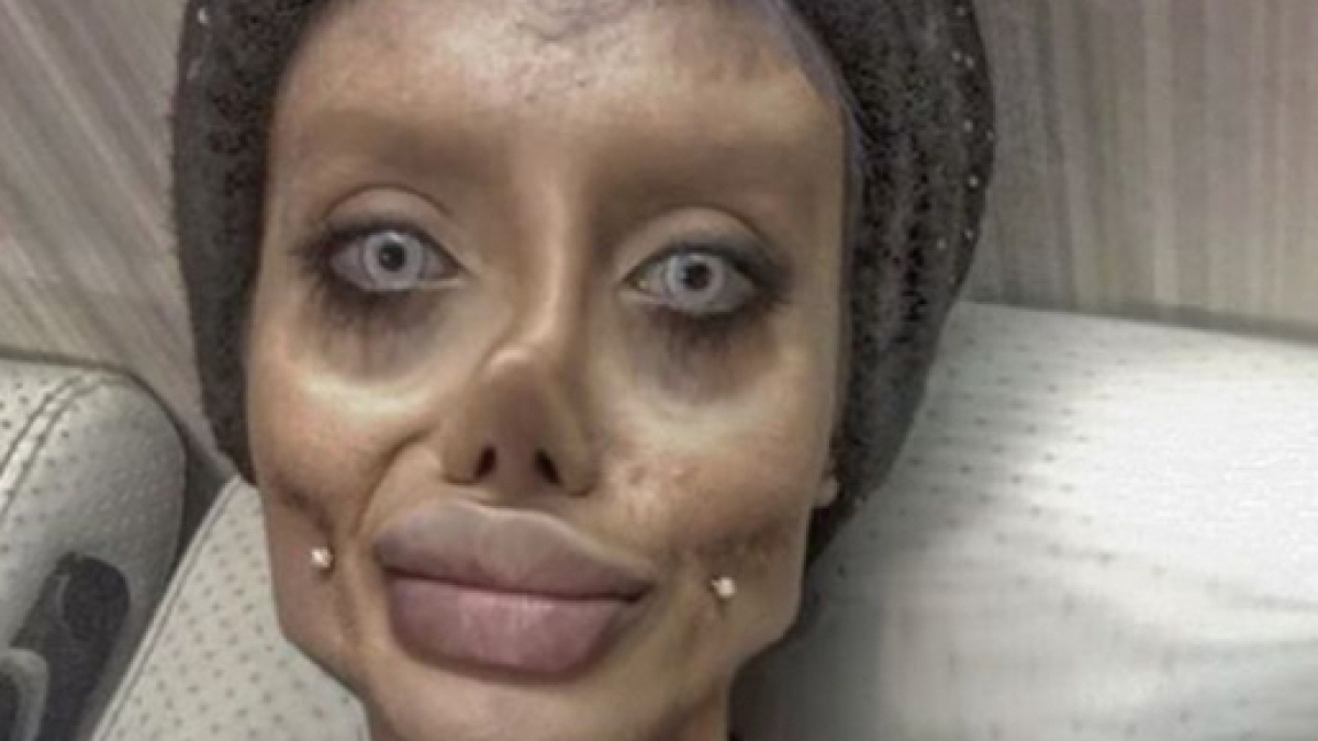 Sahar Tabar pictures Teen has 50 plastic surgeries to look like