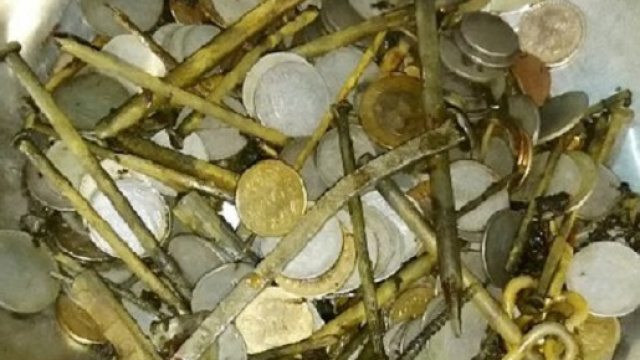 Contenuto dello stomaco di un uomo
