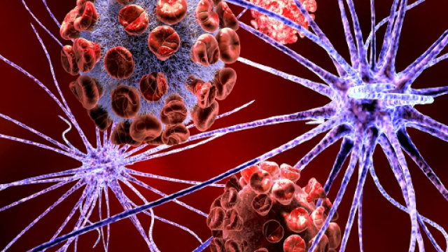 Malattia di Huntington: una nuova molecola la rallenta