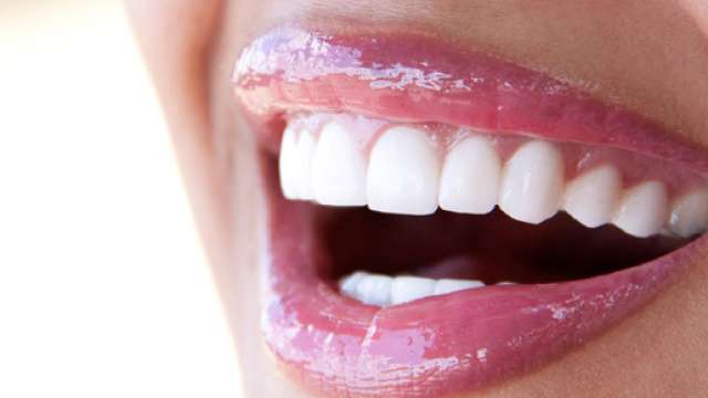 Progettazione di un sorriso perfetto | Studio Dottor Barile - studiodottorbarile.com
