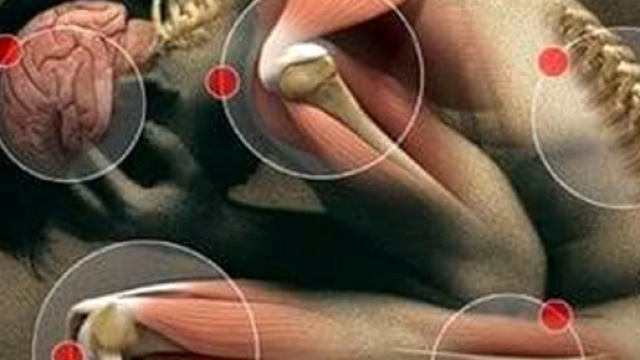 Il dolore cronico raffigurato in un'illustrazione