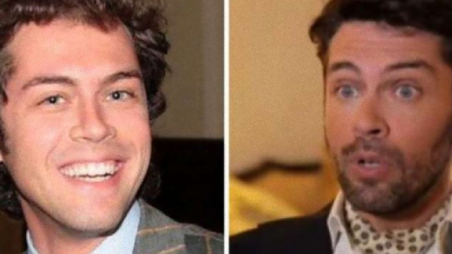 Raffaello Tonon: ecco quanto ha speso per chirurgia estetica.