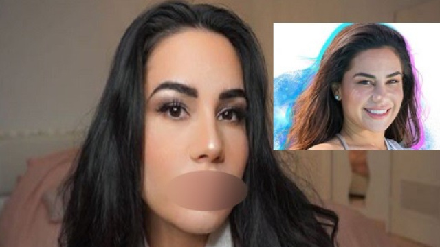 Milla Jasmine : sa derni&egrave;re op&eacute;ration de chirurgie esth&eacute;tique choque ses fans !