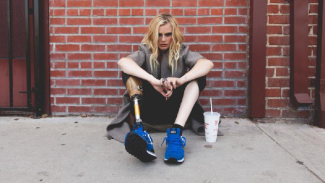 BUTAC &ndash; Bufale un tanto al chilo Perdere una gamba per colpa di un ... - butac.it