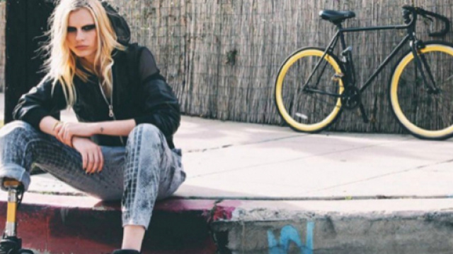 Lauren Wasser rischia l'amputazione della seconda gamba