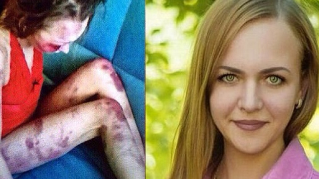 Lividi su tutto il corpo: ecco come &egrave; stata massacrata la donna.