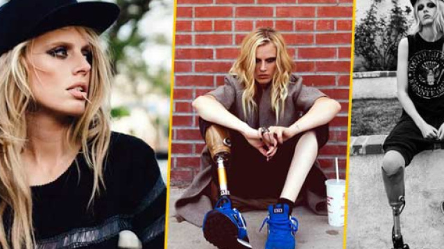 Lauren Warren rischia di perdere anche la gamba sinistra