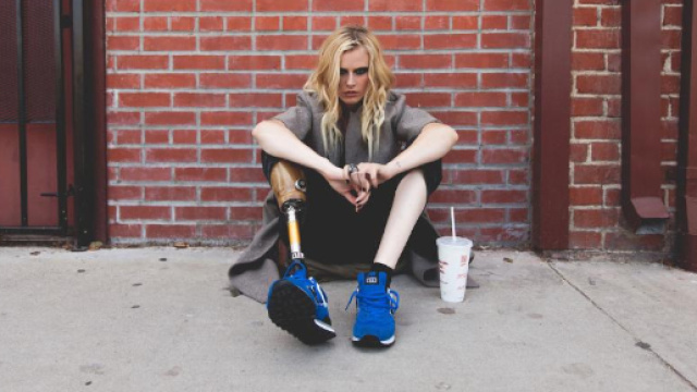 Modella perde una gamba: nuovi risvolti della tragedia di Lauren Wasser 29enne