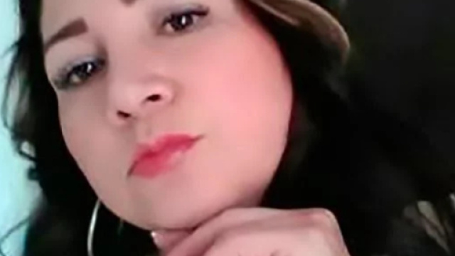 Colombia: donna muore dopo essersi operata ai glutei in un salone di bellezza