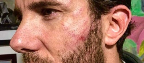 Israel Lancho 'GH VIP 3' agredido al intentar frenar un atraco