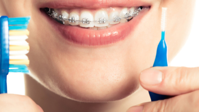 Per una corretta igiene orale, terminiamo sempre la pulizia dei denti con un collutorio delicato. - foto:unisalute.it