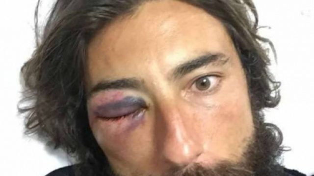 Vittorio Brumotti, l'inviato di Striscia la Notizia aggredito (immagine di repertorio)