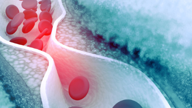 Colesterolo, anche se &egrave; basso &egrave; pericoloso