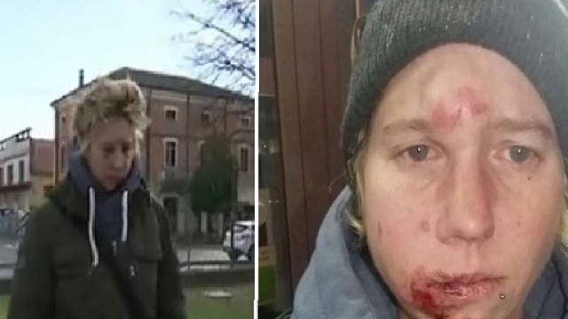 Il volto tumefatto di Sandra dopo l'aggressione