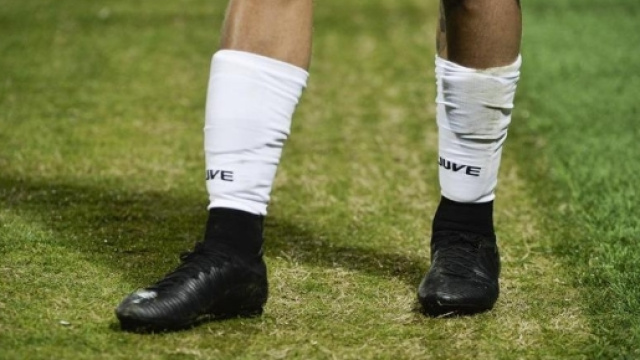 Ecco perch&eacute; Dybala s'&egrave; colorato di nero le scarpe - La Stampa