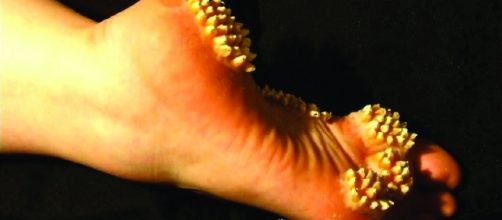 Seis fatos nojentos sobre o corpo humano