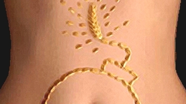 Ipersensibilit&agrave; a glutine, nichel e colon irritabile hanno elementi in comune.