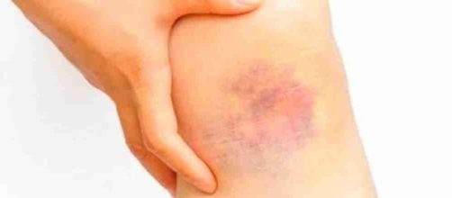 Estes s&atilde;o os primeiros sinais que indicam o c&acirc;ncer