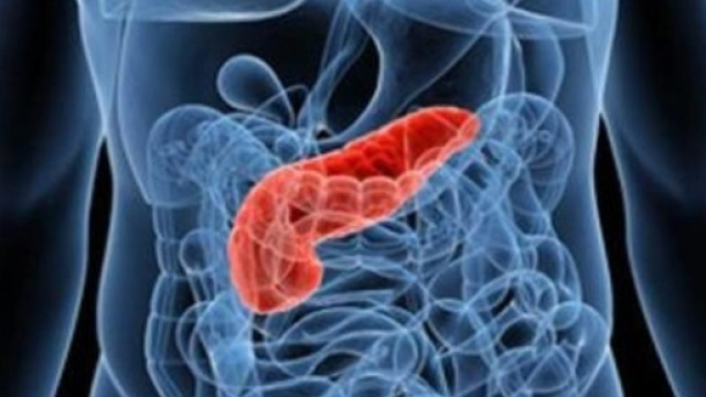 Tumore al pancreas, patologia in crescita: i sintomi da tenere d ... - lastampa.it