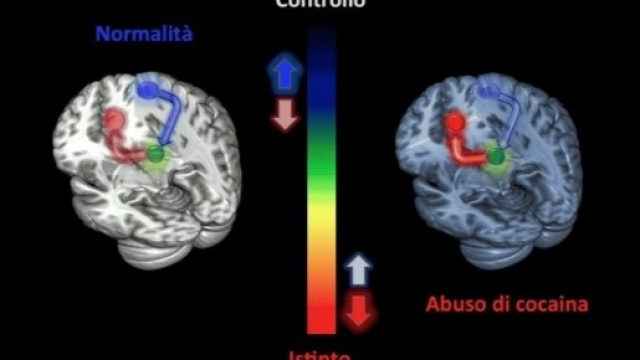 Evidente alterazione fisiologica del cervello - focus.it