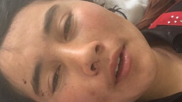 Afghanistan, taglia le orecchie alla moglie