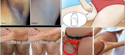 Dicas poderosas para auxiliar no clareamento de axilas, joelhos e cotovelos